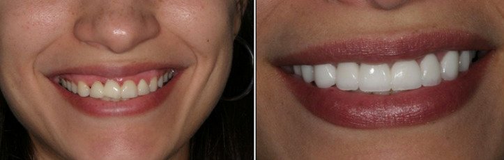 Эстетическая стоматология - 3 | https://complex-dent.com.ua