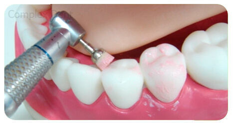 Чисті зуби не болять! - 5 | Complex Dent