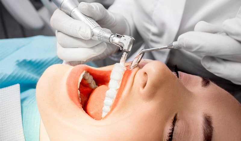 Современные технологии в эстетической стоматологии - 4 | Complex Dent