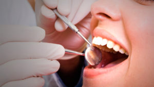 Терапевтическая стоматология – гарантия красивых зубов | Complex Dent
