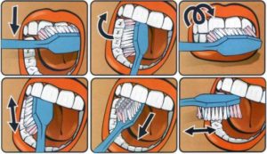 Как правильно чистить зубы - 1 | Complex Dent