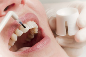 Чим можна почистити зуби в домашніх умовах - 1 | Complex Dent