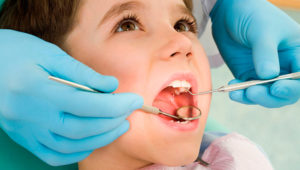 Лечение кариеса молочных зубов: стоит ли бояться? | Complex Dent