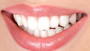 Мифы о здоровых зубах: 8 интересных фактов | Complex Dent