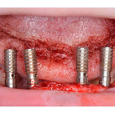 Результаты работ стоматологической клиники Complex Dent — фото 17