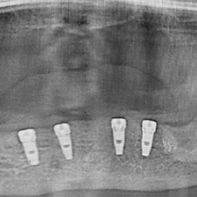 Результаты работ стоматологической клиники Complex Dent — фото 18