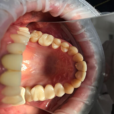 Результаты работ стоматологической клиники Complex Dent — фото 34