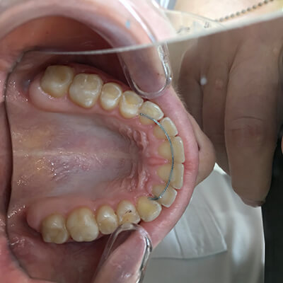 Результаты работ стоматологической клиники Complex Dent — фото 35