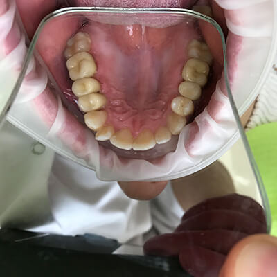 Результаты работ стоматологической клиники Complex Dent — фото 37