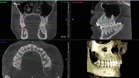Ортопантомограма -1  | https://complex-dent.com.ua
