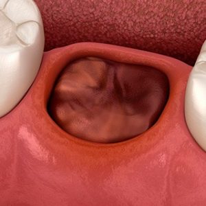 Стоматологическая Клиника Complex Dent - 16 | https://complex-dent.com.ua